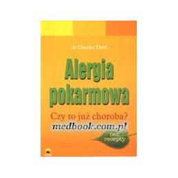 Alergia pokarmowa